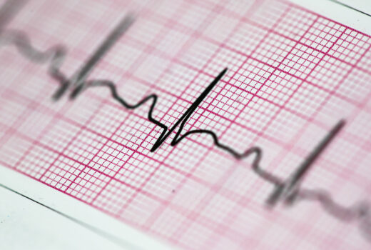 EKG elektronisches Kardiogramm